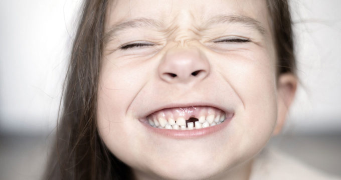 curare-denti-da-latte