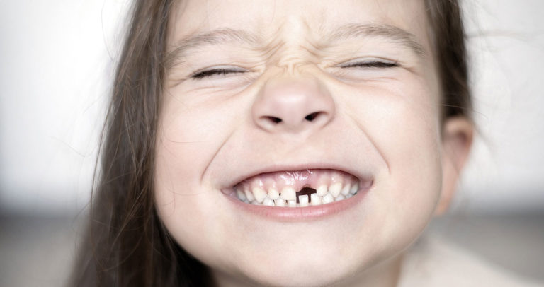 curare denti da latte