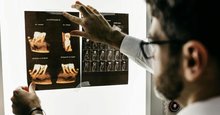 dentista che guarda lastra