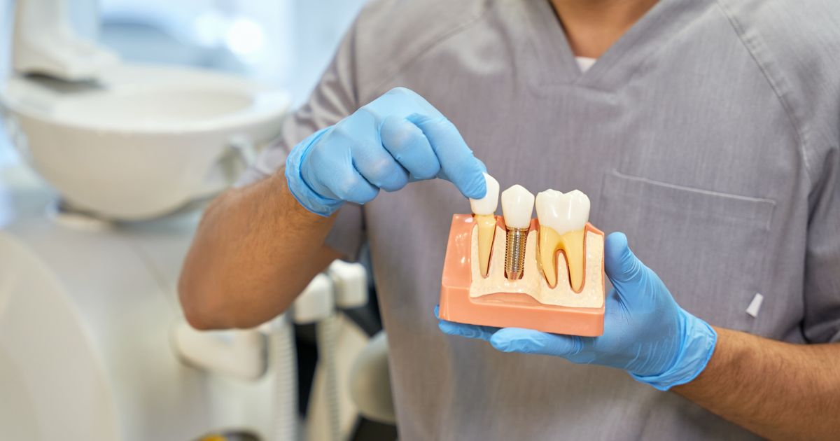 impianti dentali